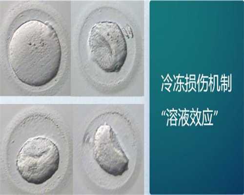 2026年4月剖腹产选日子的禁忌有哪些？可信吗？