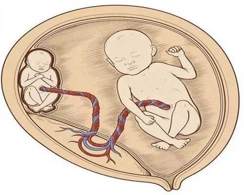 孕妇天天手脚冰凉是身体的什么原因？